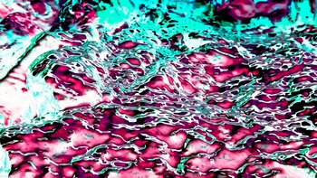 AP 169A1